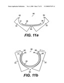 ANASTOMOTIC SEAL LOADING TOOL diagram and image