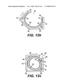 ANASTOMOTIC SEAL LOADING TOOL diagram and image