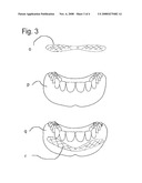 Facial Lift diagram and image