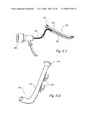 Methods and Apparatus for Treating Disorders of the Ear Nose and Throat diagram and image