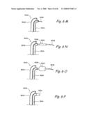 Methods and Apparatus for Treating Disorders of the Ear Nose and Throat diagram and image