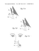 Methods and Apparatus for Treating Disorders of the Ear Nose and Throat diagram and image