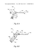 Methods and Apparatus for Treating Disorders of the Ear Nose and Throat diagram and image