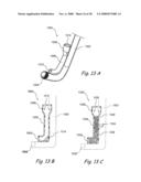 Methods and Apparatus for Treating Disorders of the Ear Nose and Throat diagram and image