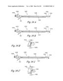 Methods and Apparatus for Treating Disorders of the Ear Nose and Throat diagram and image