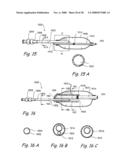 Methods and Apparatus for Treating Disorders of the Ear Nose and Throat diagram and image