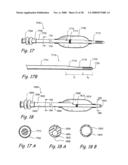 Methods and Apparatus for Treating Disorders of the Ear Nose and Throat diagram and image