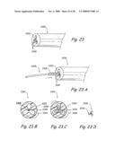 Methods and Apparatus for Treating Disorders of the Ear Nose and Throat diagram and image