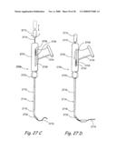 Methods and Apparatus for Treating Disorders of the Ear Nose and Throat diagram and image