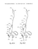 Methods and Apparatus for Treating Disorders of the Ear Nose and Throat diagram and image