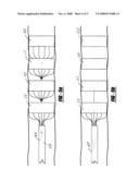 EXTENDED DURATION REMOVABLE MEDICAL FILTER diagram and image