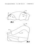 EXTENDED DURATION REMOVABLE MEDICAL FILTER WITH TISSUE BARRIER diagram and image