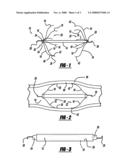 CROSSOVER RETRIEVABLE MEDICAL FILTER diagram and image