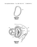 METHOD OF HEART VALVE REPAIR diagram and image