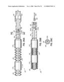 METHOD OF HEART VALVE REPAIR diagram and image