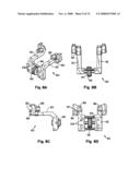 Prostheses, Tools and Methods for Replacement of Natural Facet Joints With Artificial Facet Joint Surfaces diagram and image