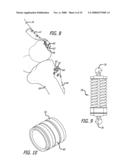 MOUNTS FOR IMPLANTABLE EXTRA-ARTICULAR SYSTEMS diagram and image