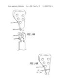 MOUNTS FOR IMPLANTABLE EXTRA-ARTICULAR SYSTEMS diagram and image