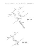 MOUNTS FOR IMPLANTABLE EXTRA-ARTICULAR SYSTEMS diagram and image