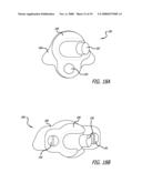 MOUNTS FOR IMPLANTABLE EXTRA-ARTICULAR SYSTEMS diagram and image