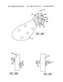 MOUNTS FOR IMPLANTABLE EXTRA-ARTICULAR SYSTEMS diagram and image