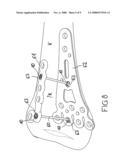 Fixation Device, Combination of a Fixation Device with an Elongate Element, Arrangment with Such a Combination and Osteosynthesis Set diagram and image