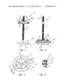 Cranium fixing device diagram and image