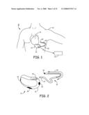 METHOD AND APPARATUS FOR DETECTING ARRHYTHMIAS IN A MEDICAL DEVICE diagram and image