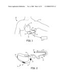 METHOD AND APPARATUS FOR DETECTING ARRHYTHMIAS IN A MEDICAL DEVICE diagram and image