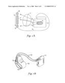 Vector Switching in an Implantable Cardiac Stimulus System diagram and image