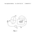 Vector Switching in an Implantable Cardiac Stimulus System diagram and image