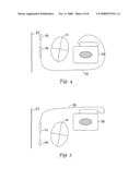 Vector Switching in an Implantable Cardiac Stimulus System diagram and image