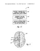 Methods and Apparatus for Effectuating a Lasting Change in a Neural Function of a Patient, Including Via Mechanical Force on Neural Tissue diagram and image