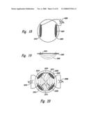 Methods and Apparatus for Effectuating a Lasting Change in a Neural Function of a Patient, Including Via Mechanical Force on Neural Tissue diagram and image