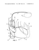 IMPLANTABLE HIGH EFFICIENCY DIGITAL STIMULATION DEVICE diagram and image