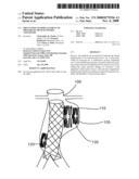 PREVENTION OF DISPLACEMENT OF PROSTHETIC DEVICES WITHIN ANEURYSMS diagram and image