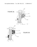 PREVENTION OF DISPLACEMENT OF PROSTHETIC DEVICES WITHIN ANEURYSMS diagram and image