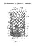 Artificial Heart Valve Stent and Weaving Method Thereof diagram and image