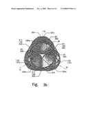 Artificial Heart Valve Stent and Weaving Method Thereof diagram and image