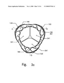 Artificial Heart Valve Stent and Weaving Method Thereof diagram and image
