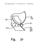 Artificial Heart Valve Stent and Weaving Method Thereof diagram and image