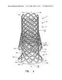 Artificial Heart Valve Stent and Weaving Method Thereof diagram and image