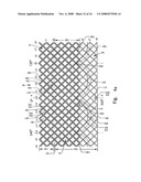 Artificial Heart Valve Stent and Weaving Method Thereof diagram and image