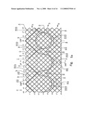 Artificial Heart Valve Stent and Weaving Method Thereof diagram and image