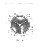 Artificial Heart Valve Stent and Weaving Method Thereof diagram and image