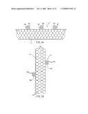 IMPLANTABLE DEVICES FOR THE TREATMENT OF INTERSECTING LUMENS diagram and image