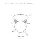 IMPLANTABLE DEVICES FOR THE TREATMENT OF INTERSECTING LUMENS diagram and image