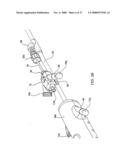 IMPLANTABLE DEVICES FOR THE TREATMENT OF INTERSECTING LUMENS diagram and image