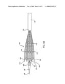 IMPLANTABLE DEVICES FOR THE TREATMENT OF INTERSECTING LUMENS diagram and image