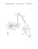 IMPLANTABLE DEVICES FOR THE TREATMENT OF INTERSECTING LUMENS diagram and image